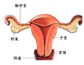 附件炎的发生和哪些因素有关
