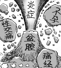 急性盆腔炎有什么症状