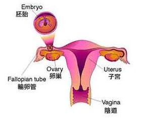 预防卵巢性不孕要做哪些准备