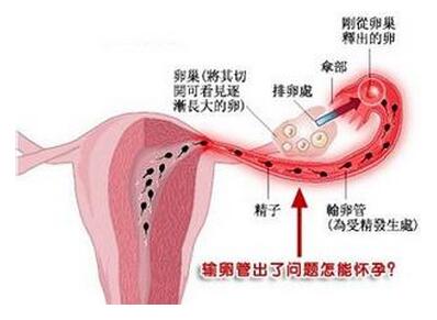 输卵管堵塞会影响月经吗